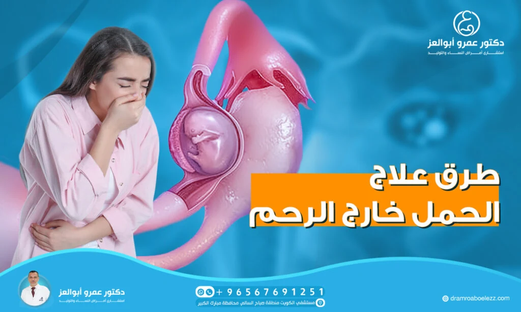 طرق علاج الحمل خارج الرحم