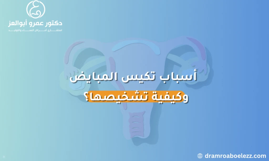 صورة توضح أسباب تكيس المبايض وكيفية تشخيصها، مع إبراز العوامل التي تؤدي إلى حدوث المتلازمة.