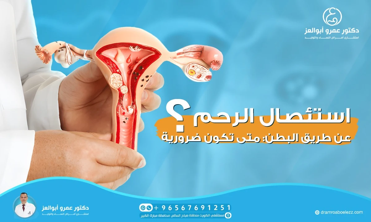 استئصال الرحم عن طريق البطن: متى تكون ضرورية؟