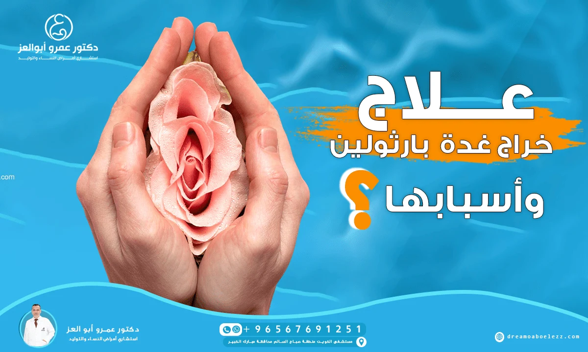 علاج خراج غدة بارثولين وأسبابها