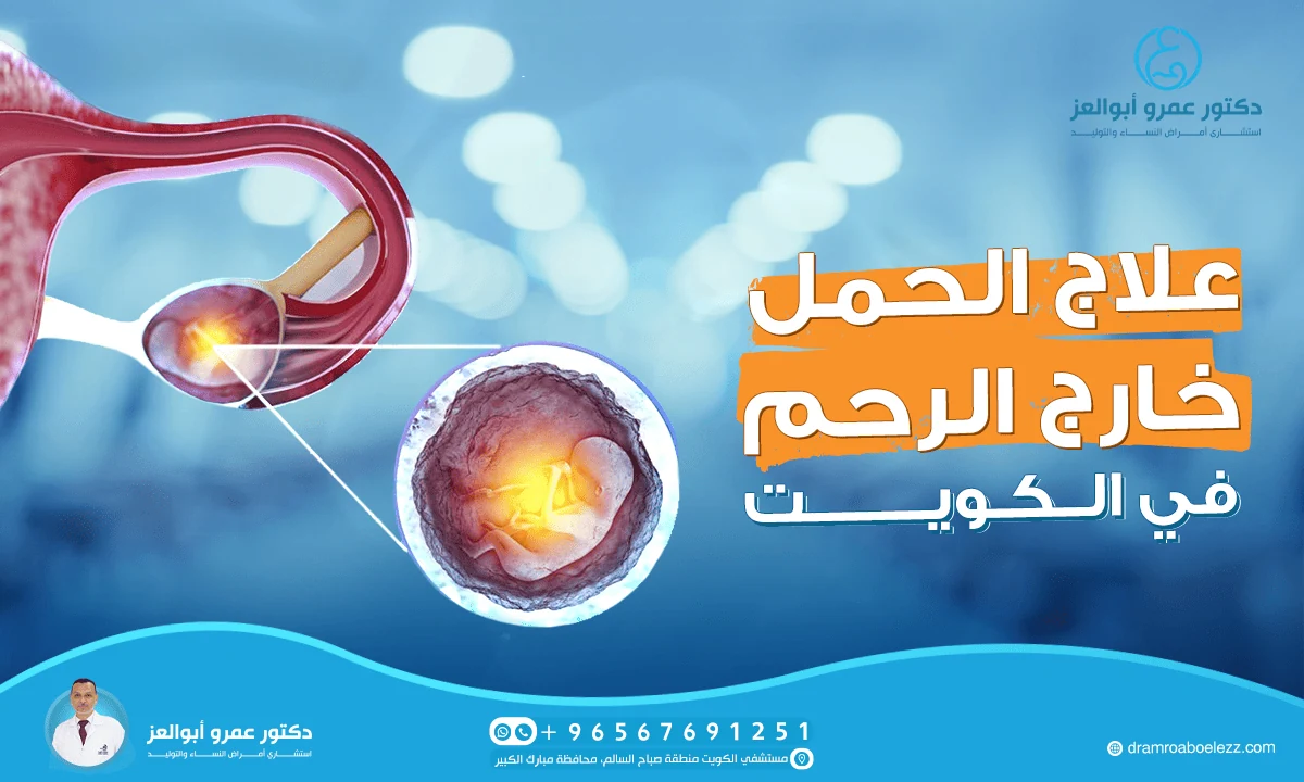 أفضل دكتور لعلاج الحمل خارج الرحم في الكويت