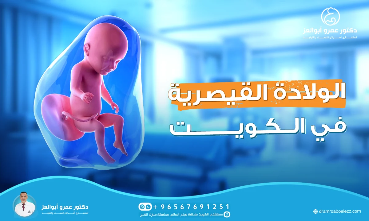 أفضل دكتور للولادة القيصرية في الكويت