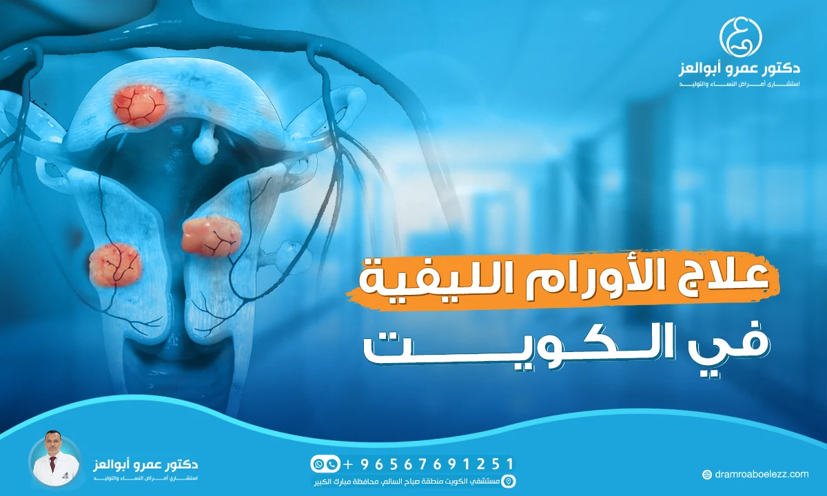 أفضل دكتور لعلاج الأورام الليفية في الكويت