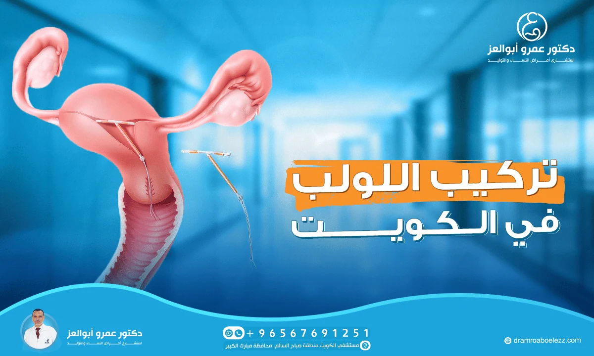 أفضل دكتور لتركيب اللولب في الكويت