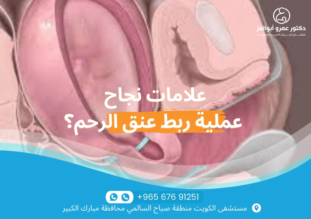 علامات نجاح عملية ربط عنق الرحم - غياب الانقباضات المبكرة، عدم وجود قمع في عنق الرحم، واستقرار الحمل مع أفضل دكتور في الكويت.