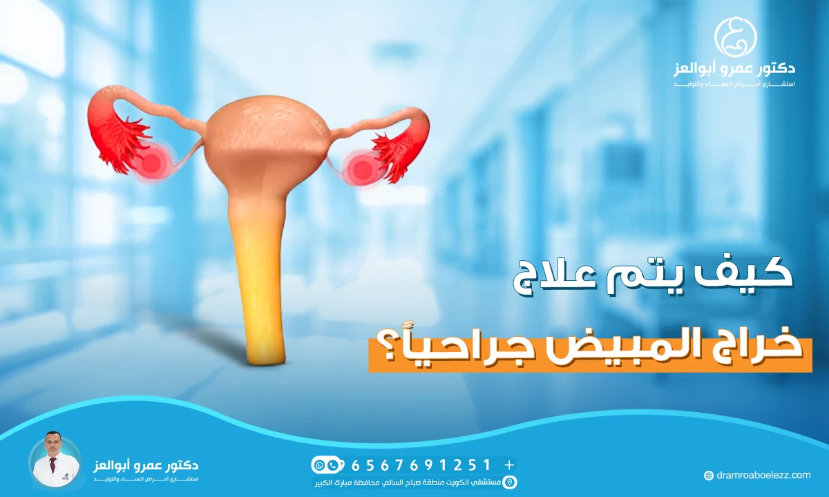 كيف يتم علاج خراج المبيض جراحياً؟