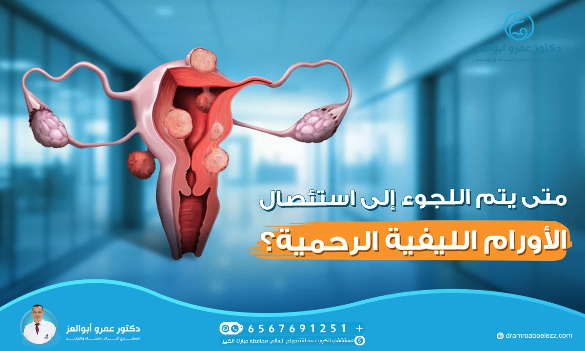 متى يتم اللجوء إلى استئصال الأورام الليفية الرحمية؟