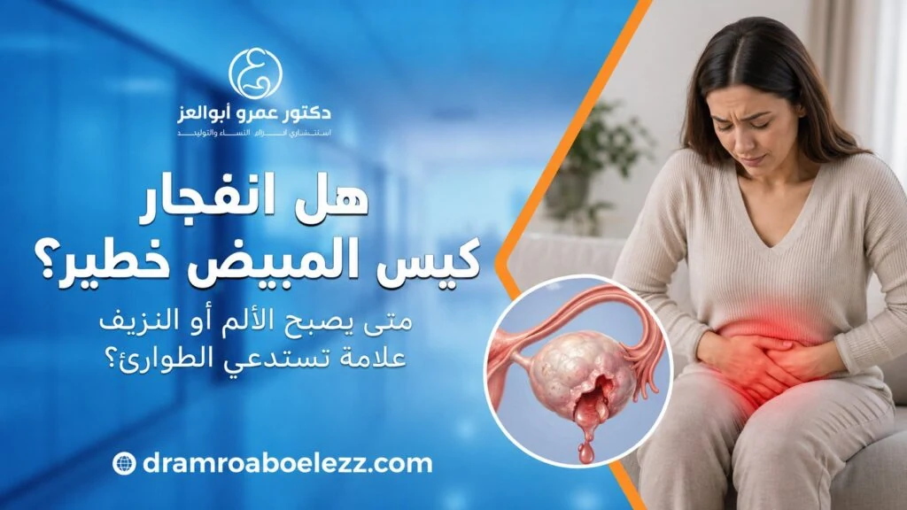 سيدة تعاني من ألم حاد أسفل البطن مع رسم توضيحي لانفجار كيس المبيض وأعراضه التحذيرية.