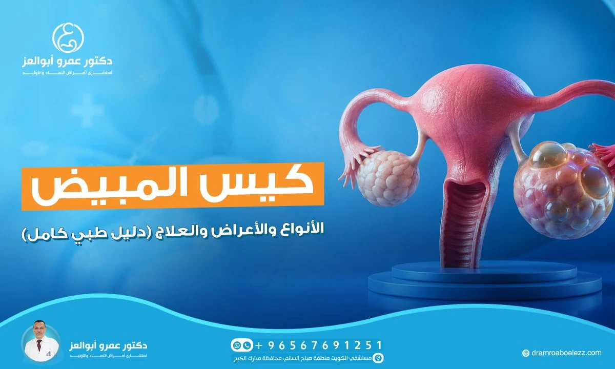 كيس المبيض: الأنواع والأعراض والعلاج (دليل طبي كامل)