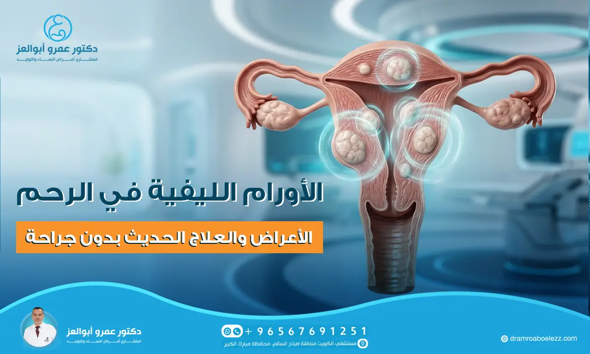 الأورام الليفية في الرحم: الأعراض والعلاج الحديث بدون جراحة