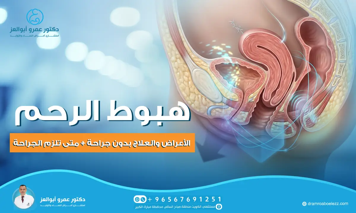 هبوط الرحم: الأعراض والعلاج بدون جراحة + متى تلزم الجراحة