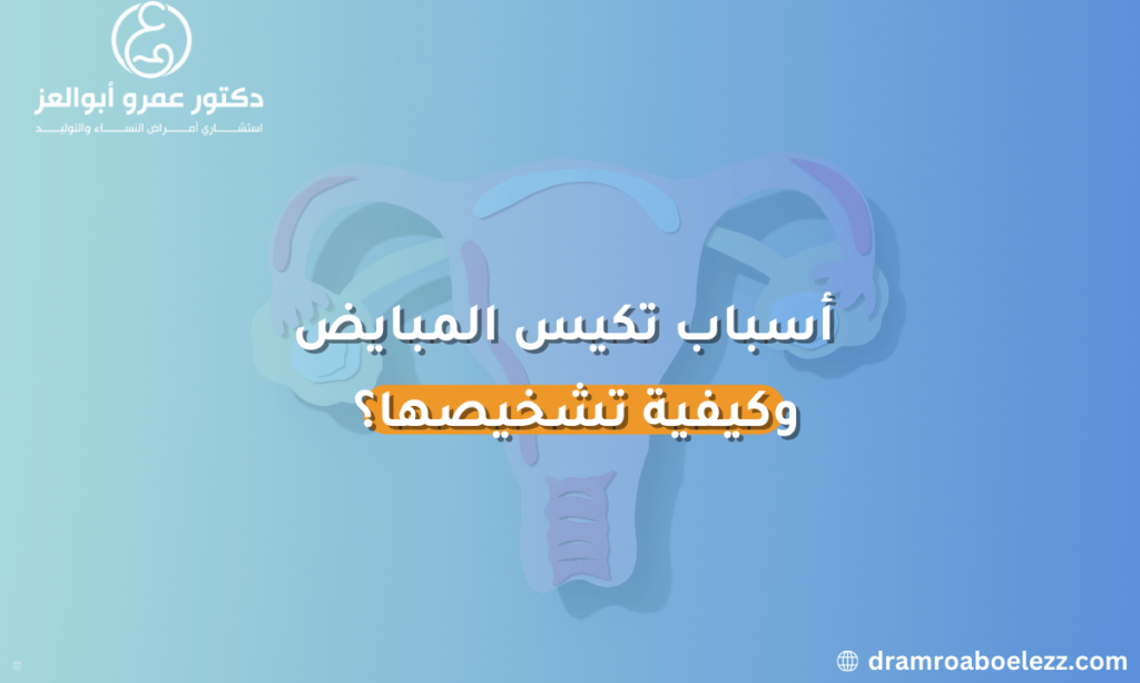 صورة توضح أسباب تكيس المبايض وكيفية تشخيصها، مع إبراز العوامل التي تؤدي إلى حدوث المتلازمة.