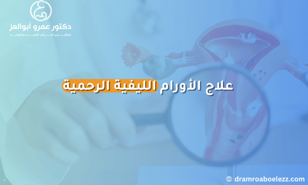 "علاج الأورام الليفية الرحمية يشمل طرقًا متعددة من بينها الأدوية والعلاج الجراحي، ويهدف إلى تقليل الأعراض وتحسين جودة الحياة