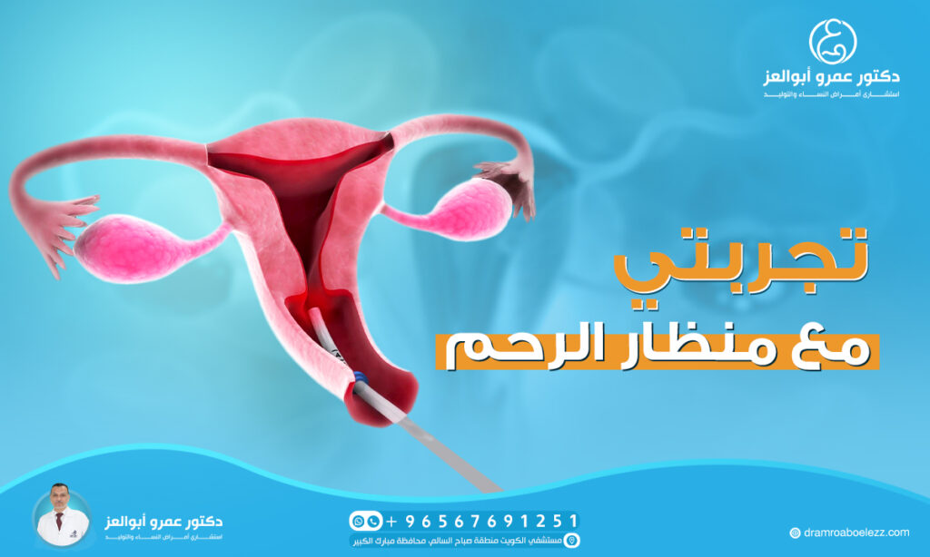 تجربتي مع منظار الرحم