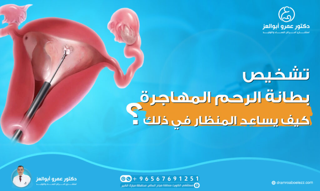 تشخيص بطانة الرحم المهاجرة: كيف يساعد المنظار في ذلك؟
