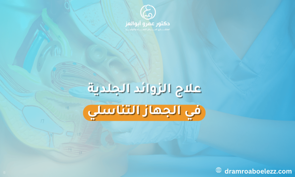 صورة توضح طرق علاج الزوائد الجلدية في الجهاز التناسلي مثل الكريمات الموضعية، الليزر، أو الجراحة.