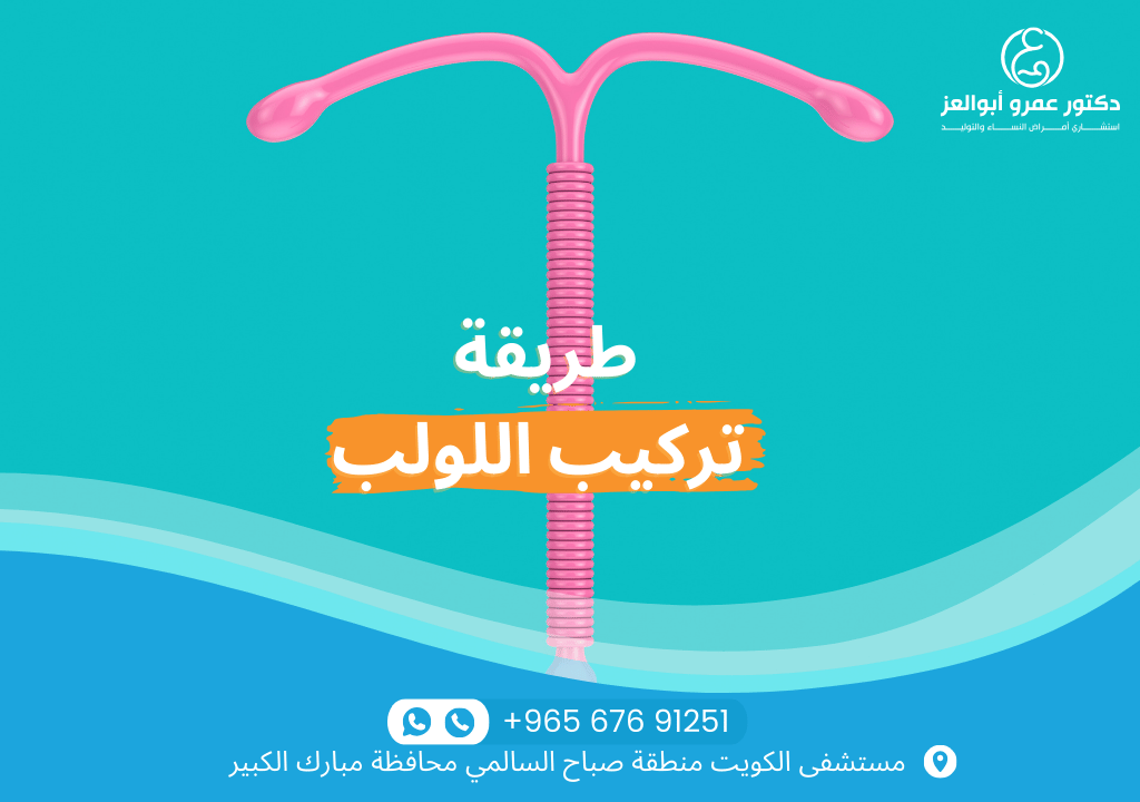 طريقة تركيب اللولب - خطوات إدخال اللولب الرحمي بواسطة طبيب متخصص، من تنظيف الرحم إلى تأكيد الموضع الصحيح.