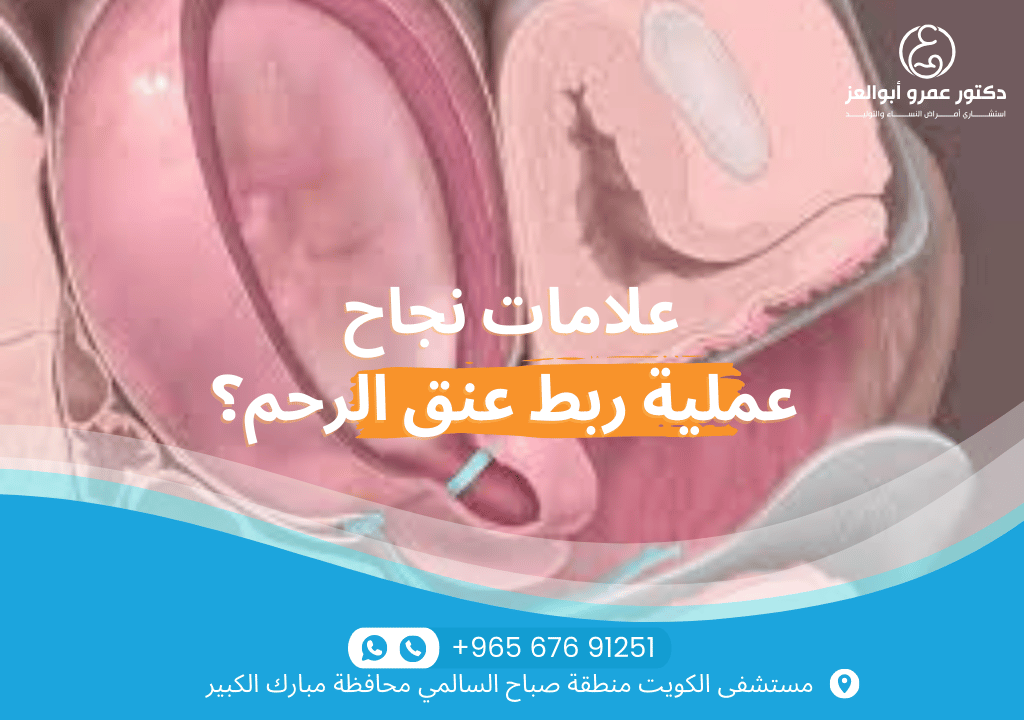علامات نجاح عملية ربط عنق الرحم - غياب الانقباضات المبكرة، عدم وجود قمع في عنق الرحم، واستقرار الحمل مع أفضل دكتور في الكويت.