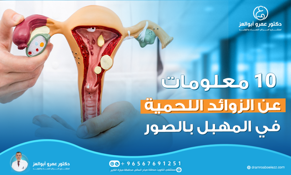 10 معلومات عن زوائد لحمية في المهبل بالصور