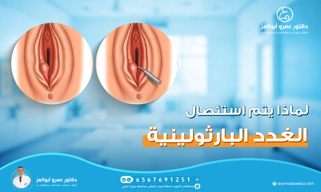 لماذا يتم استئصال الغدد البارثولينية؟