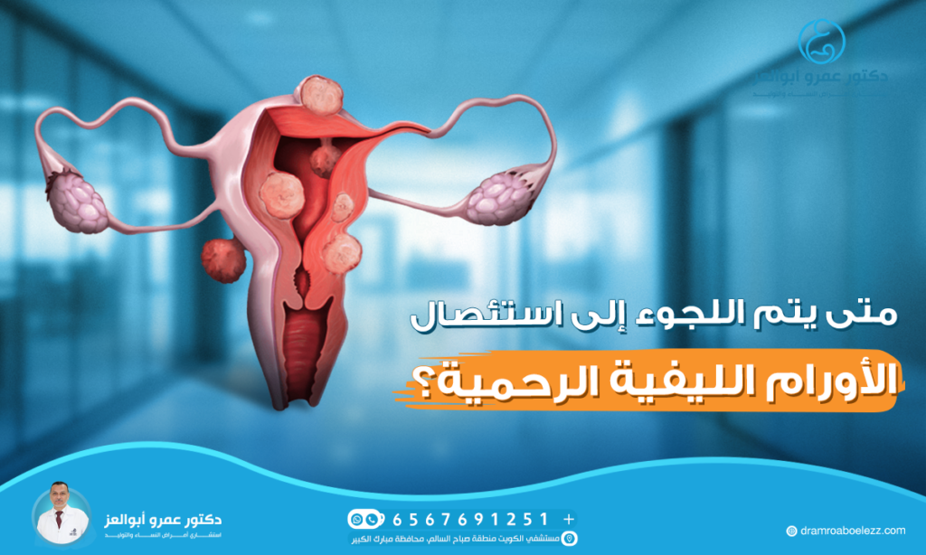 متى يتم اللجوء إلى استئصال الأورام الليفية الرحمية؟