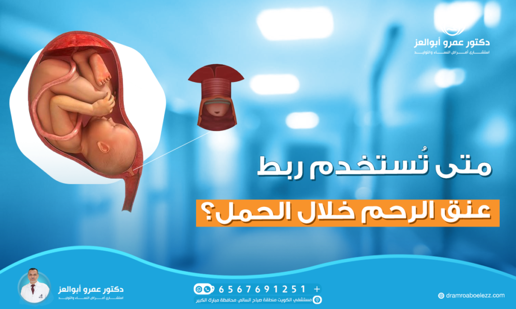 متى تُستخدم ربط عنق الرحم خلال الحمل؟