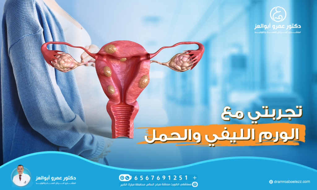 تجربتي مع الورم الليفي والحمل