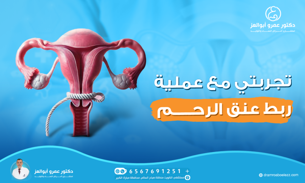 تجربتي مع عملية ربط عنق الرحم